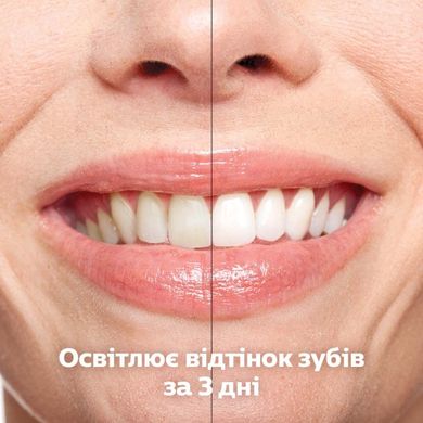 Електричні зубні щітки Philips DiamondClean 9000 HX9911/09 фото