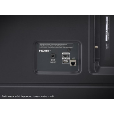 LG 75UQ9100 (75UQ91006LA)