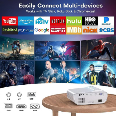 Topvision BL69 (4270003518888)